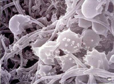 Biofilm bacteria (MPKB)