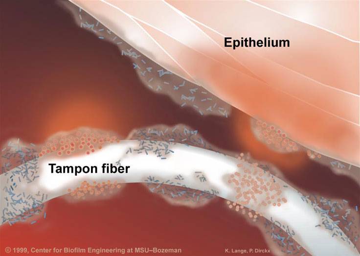 Colonization of tampon fibers and vaginal tissue