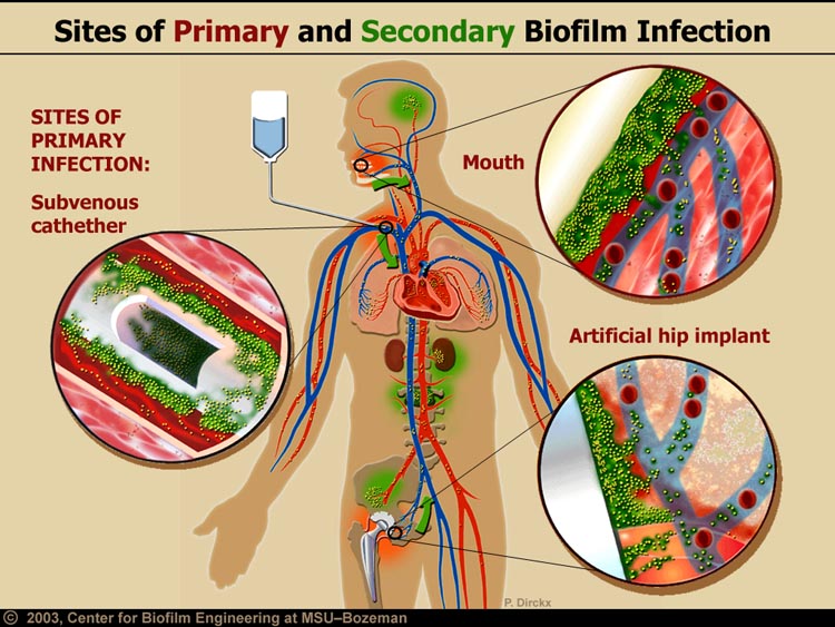 Biofilm bacteria (MPKB)