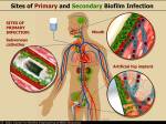 Common sites of biofilm infection