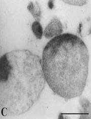 Large bodies of the L-form Staphylococcus