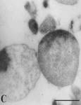 Large bodies of the L-form Staphylococcus