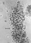 Large L-form granules with dense cores